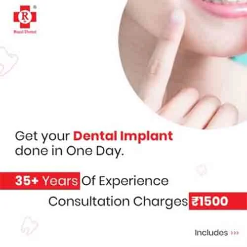 One Day Dental Implants