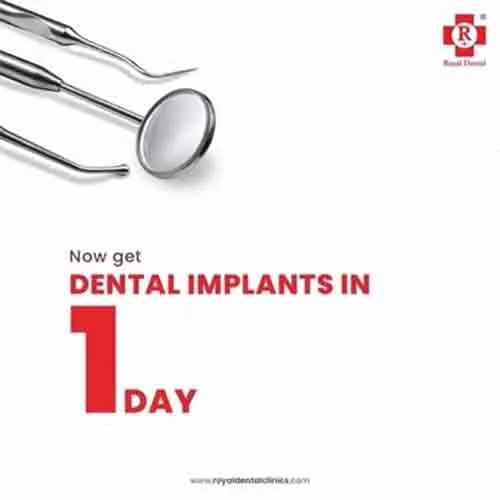 Royal dental clinics For One Day Dental Implant