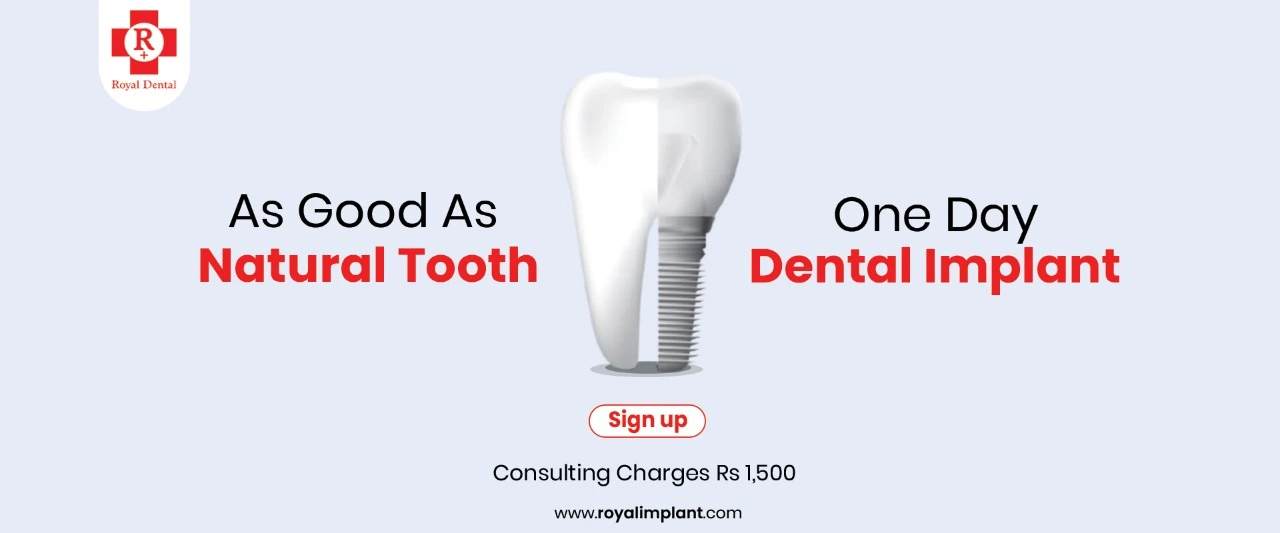 One Day Dental Implant
